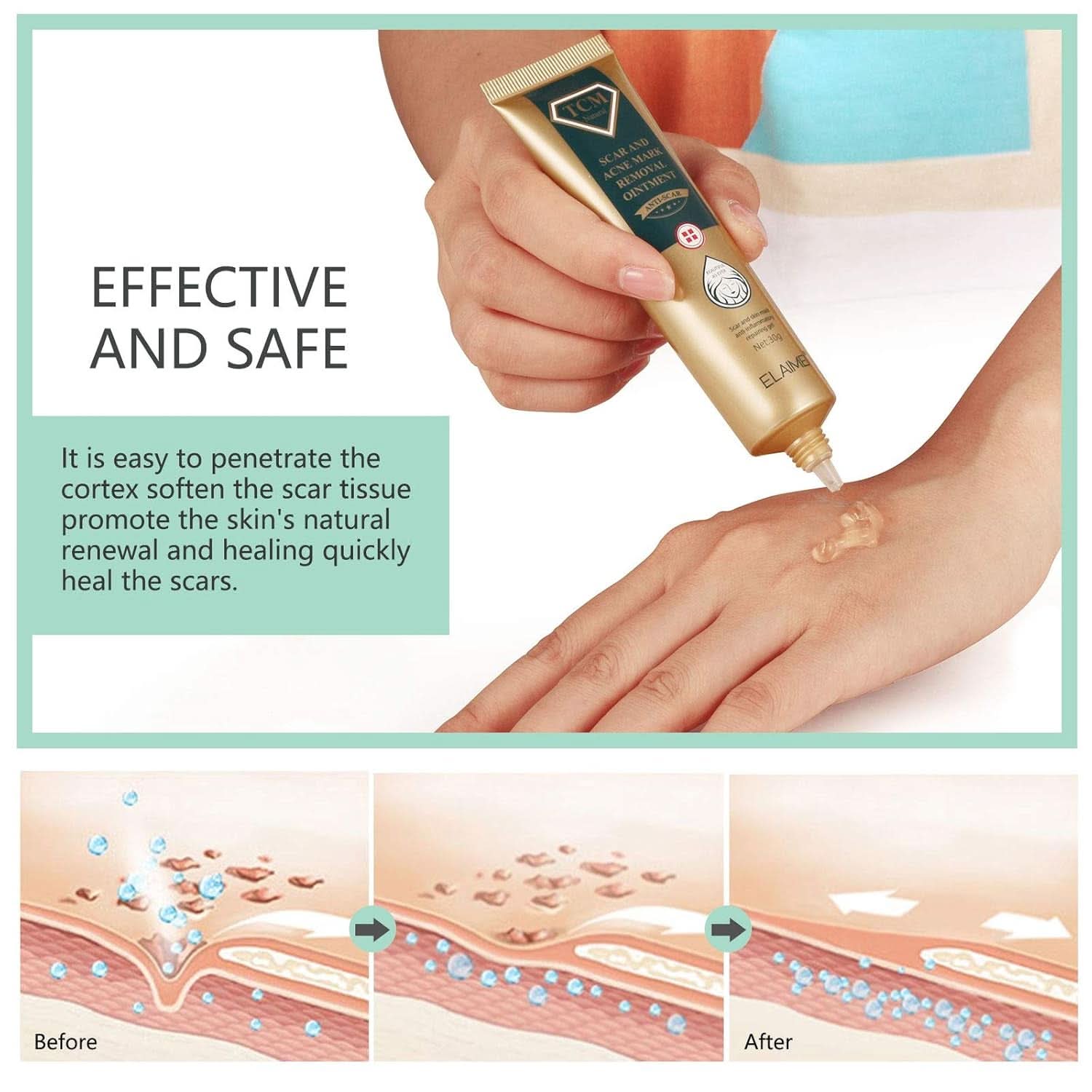 Gel para cicatrices, 30g Cosmética y Belleza Naty Shop