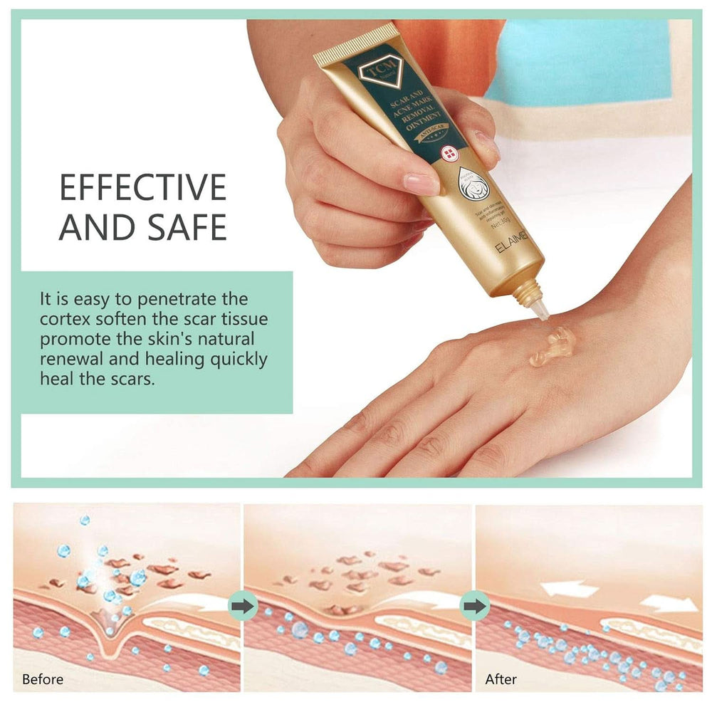 Gel para cicatrices, 30g Cosmética y Belleza Naty Shop