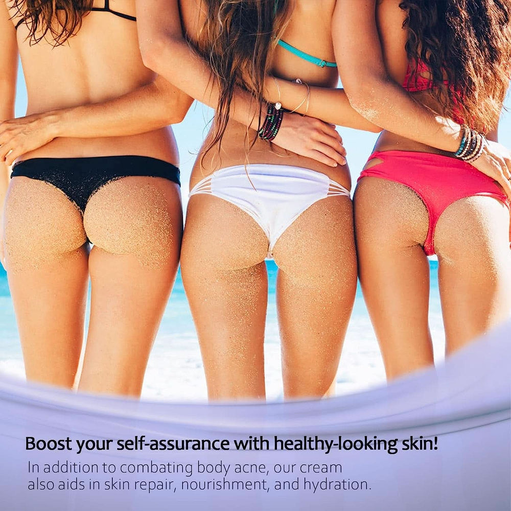 Crema antiacné 100 ml Cosmética y Belleza Naty Shop