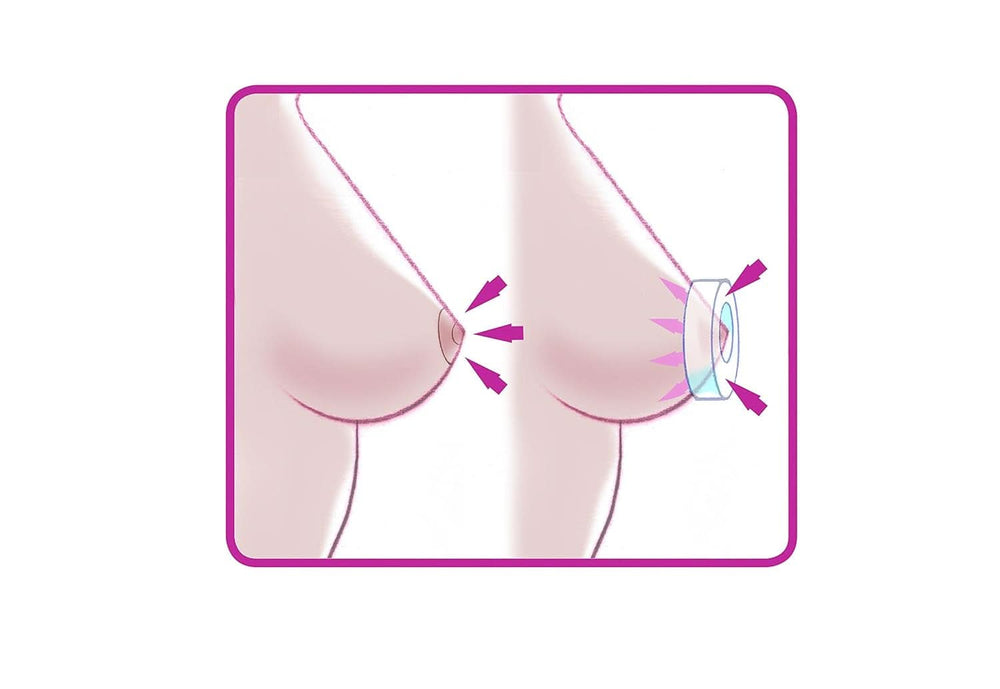 ELANEE Brust-Ringe, Schutz Der Brustwarze Bh-Kontakt Durch Hohllagerung, Ideal Bei Wunden, Entzündeten Brustwarzen Durch Stillen, 10 Stück (222-00) Accesorios Alimentación y Lactancia Bebe Naty Shop