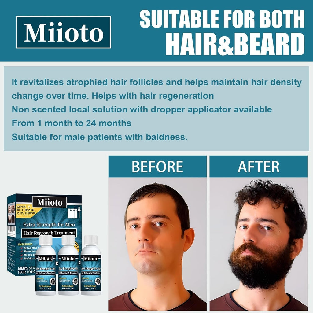 Miioto Hair Growth Serum, 180 ML Produs de creștere a părului pentru bărbați, ser de păr pentru creșterea părului, îngrijirea scalpului Promovează părul mai gros Hrănește scalpul și previne căderea părului Ingrijirea parului Naty Shop