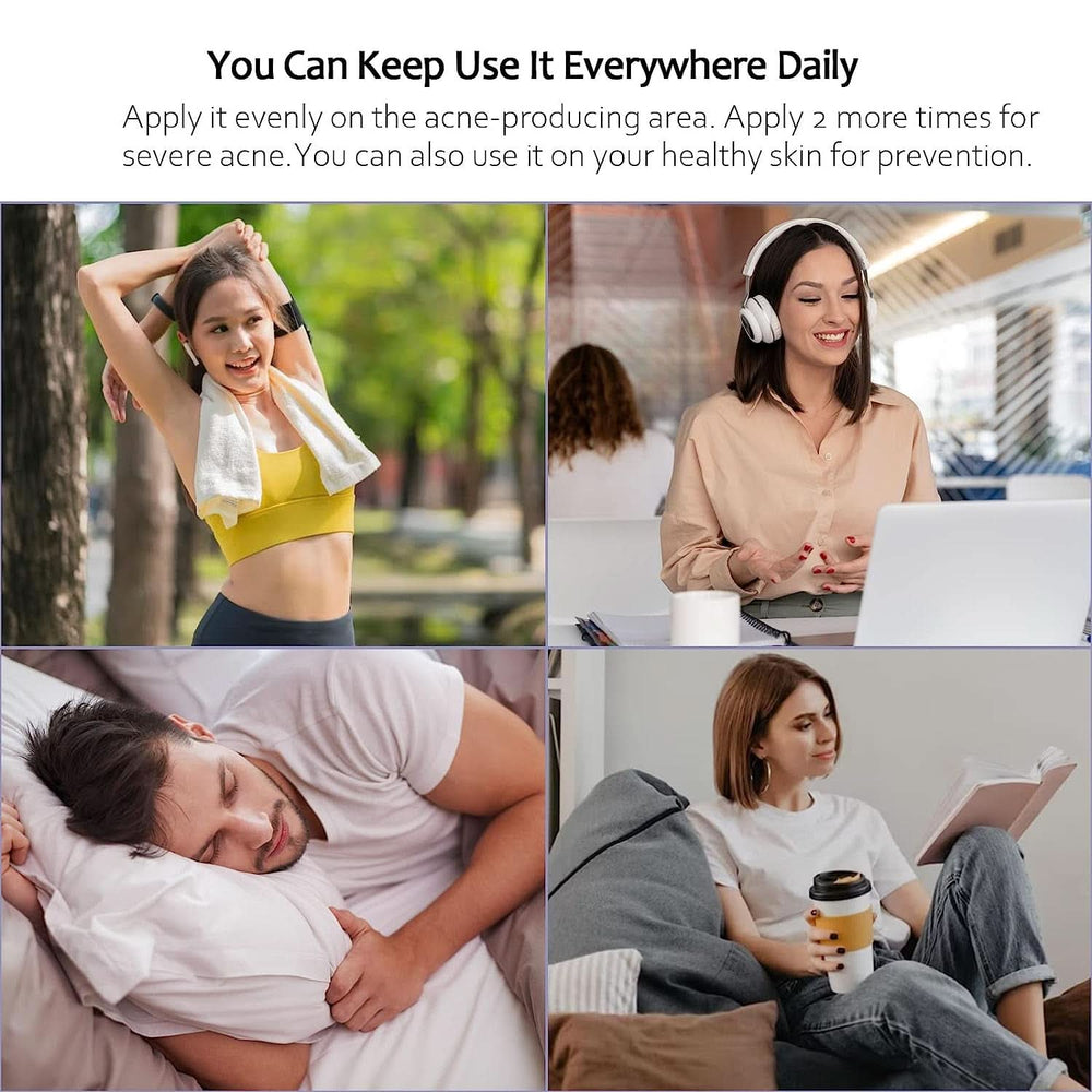 Crema antiacné 100 ml Cosmética y Belleza Naty Shop