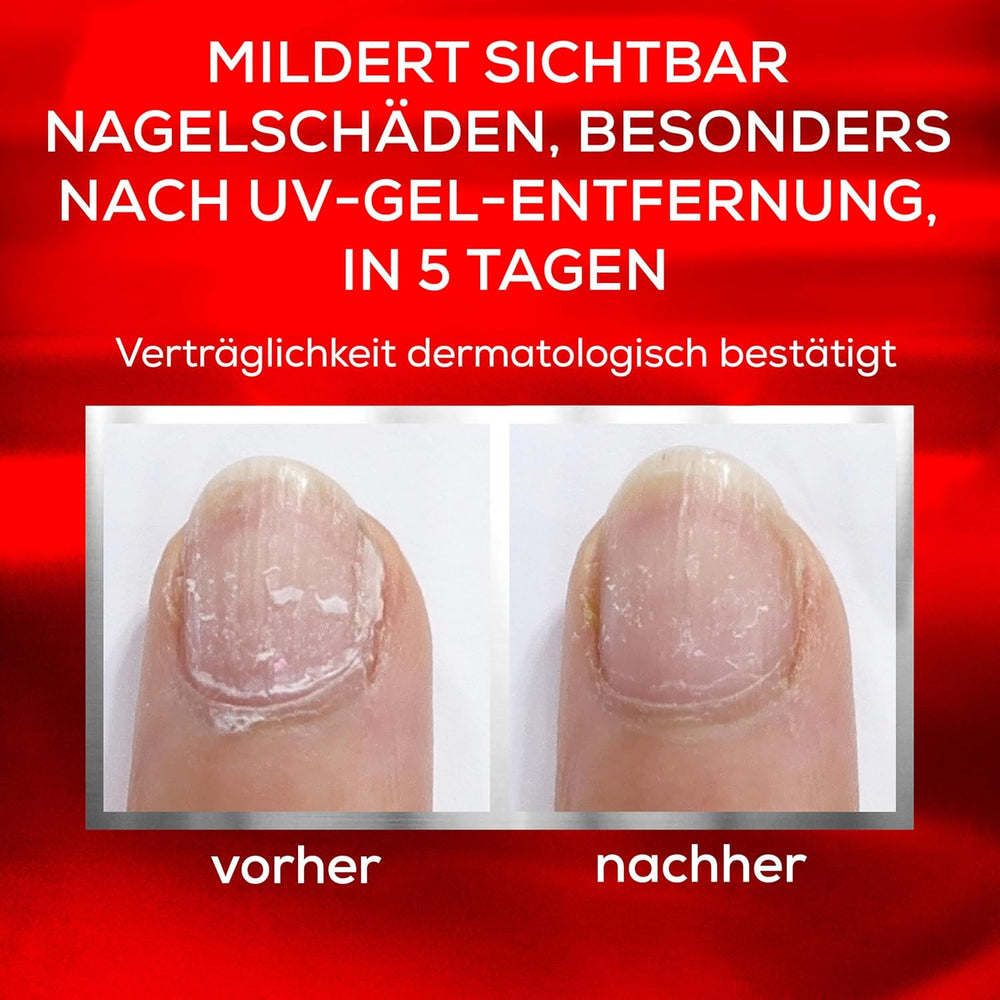 Essie Nail Rescue Kit: aceite para cutículas y uñas con aroma a albaricoque + esmalte de uñas reparador To the Rescue